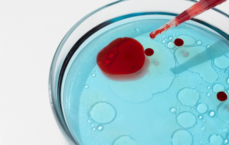 Read more about the article IgA 검사 수치 완벽 해석 면역글로불린 A 높을 때 낮을 때 원인과 음식