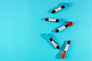 Read more about the article C-peptide 검사 수치와 의미 췌장 기능 정밀 진단