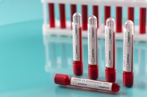 Read more about the article 베타 HCG (β-hCG) 검사와 임신 단계별 필수 검사 가이드