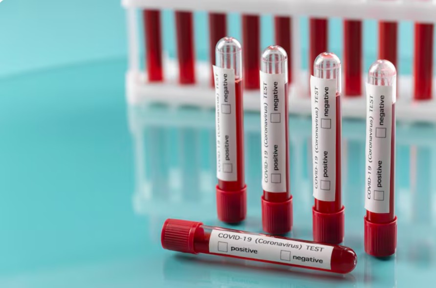 Read more about the article 베타 HCG (β-hCG) 검사와 임신 단계별 필수 검사 가이드