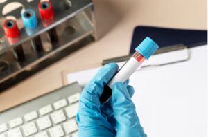 Read more about the article Insulin Ab (인슐린 자가항체) 검사 의미와 결과 해석 – 1형 당뇨 진단