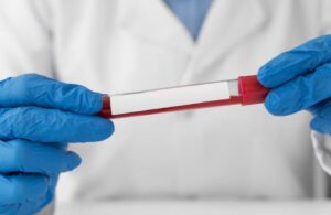 Read more about the article Troponin I 검사 수치 해석 및 심장에 좋은 음식 가이드