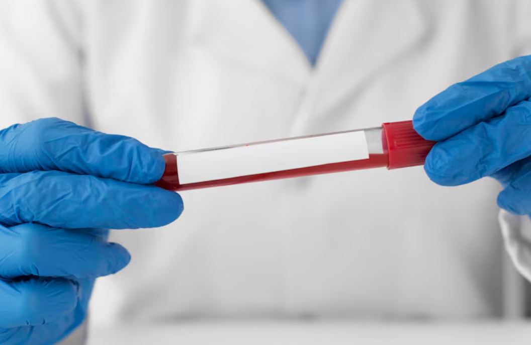 You are currently viewing Troponin I 검사 수치 해석 및 심장에 좋은 음식 가이드