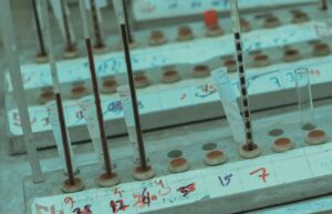 Read more about the article Phosphorus 검사 정상 수치, 높을 때·낮을 때 원인 및 칼슘 대사 관계