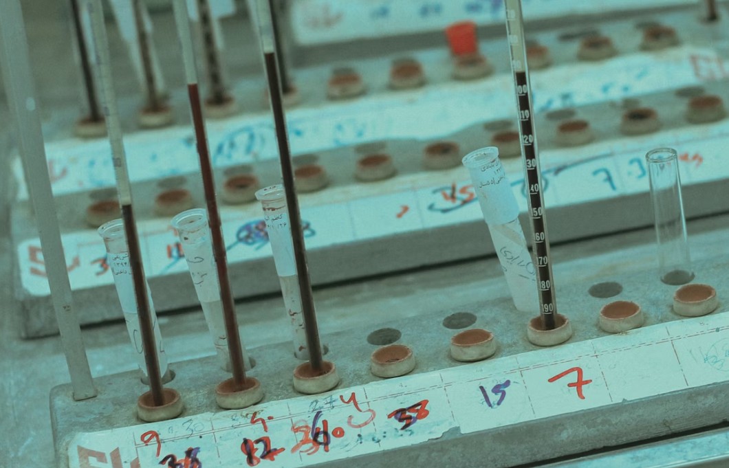 Read more about the article Phosphorus 검사 정상 수치, 높을 때·낮을 때 원인 및 칼슘 대사 관계