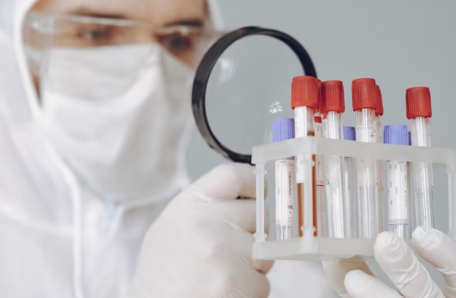 You are currently viewing 췌장소도세포 항체 (ICA) 검사: 1형 당뇨를 확진하는 면역 지표