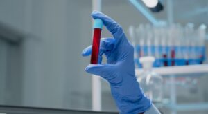 Read more about the article Glucagon 검사 수치와 의미 저혈당과 췌장 건강 진단