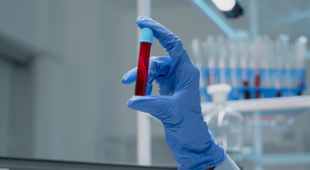 Read more about the article Glucagon 검사 수치와 의미 저혈당과 췌장 건강 진단