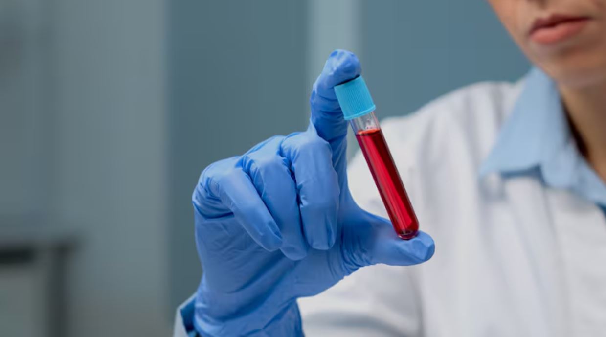 Read more about the article Cholinesterase 검사 정상수치, 높을 때·낮을 때 원인 및 관리방법