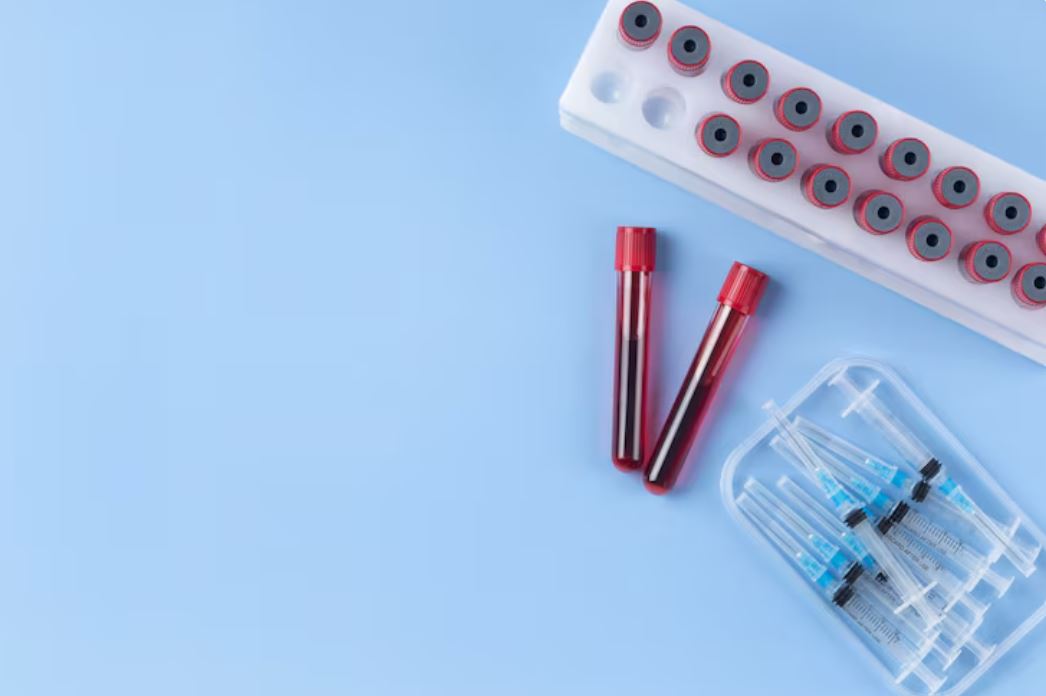 You are currently viewing Troponin T 검사 수치 해석 및 심근경색 진단 가이드