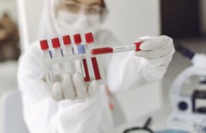 Read more about the article Digoxin 혈중 농도 검사 해석 및 주의사항 가이드