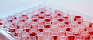 Read more about the article IgM 검사 정상 수치 해석 높을 때와 낮을 때의 원인 및 면역력 강화 음식