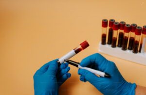 Read more about the article Free T4 검사 정상 수치, 높을 때·낮을 때 원인 및 갑상선 호르몬 평가