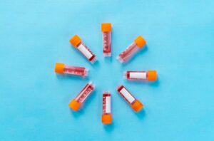 Read more about the article Magnesium 검사 높을 때, 낮을 때 원인과 관리법