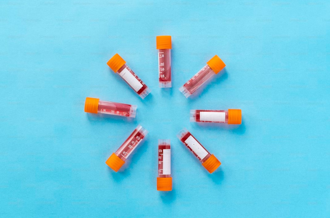 You are currently viewing Magnesium 검사 높을 때, 낮을 때 원인과 관리법