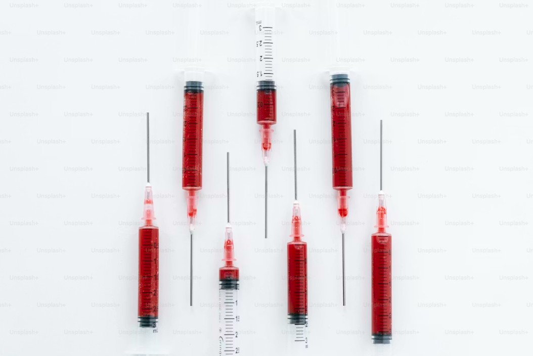 You are currently viewing C4 보체 검사 수치 완벽 판독: 정상 범위와 수치 저하 시 의심되는 질환