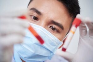 Read more about the article IgD 항체 분석 정상 수치, 증가/감소 원인, 식사 방법 및 B세포 기능 평가