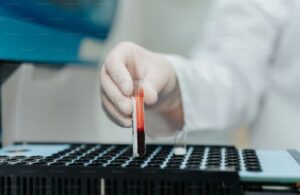 Read more about the article TIBC 검사 정상 수치, 높을 때·낮을 때 원인 및 철분 운반 능력 평가