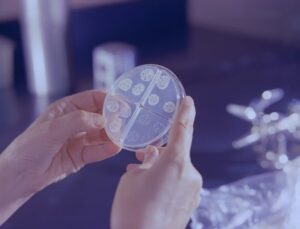 Read more about the article T-SPOT vs QuantiFERON 결핵 검사 차이점 및 상황별 권고 사항