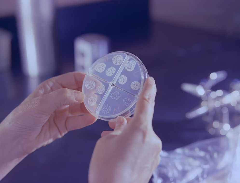 Read more about the article T-SPOT vs QuantiFERON 결핵 검사 차이점 및 상황별 권고 사항