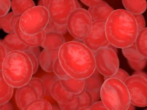 Read more about the article LE cell(루푸스 세포) 검사 원리, 판독, 그리고 임상적 의미