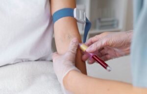 Read more about the article TBG 검사 갑상선 호르몬 수치 해석의 핵심 변수