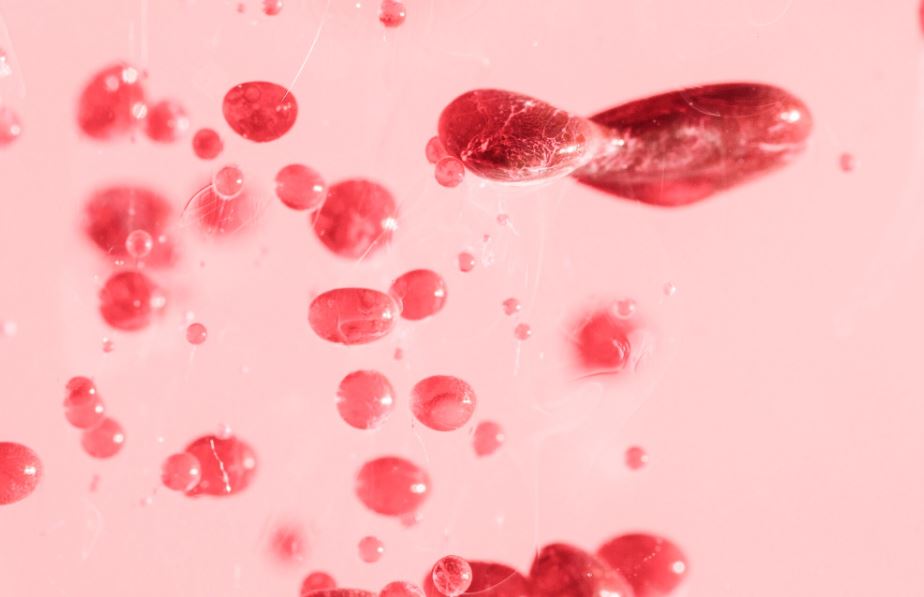 You are currently viewing PBS(말초혈액도말검사) 가이드 이상세포 판독과 임상적 의미