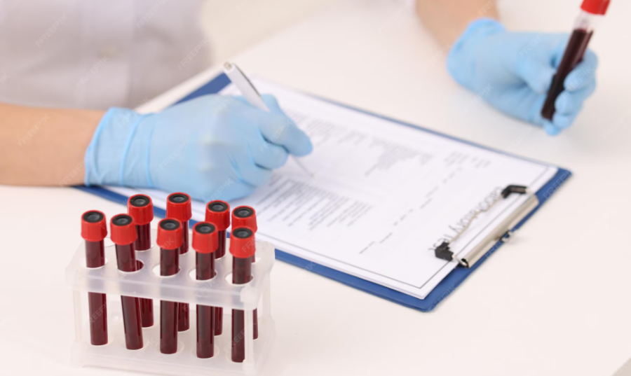 Read more about the article FDP(섬유소 분해 산물) 검사 상승의 의미와 혈액 응고 장애 진단