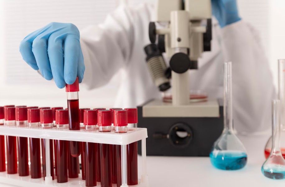 Read more about the article Lupus Anticoagulant(LA) 검사 수치 해석과 항인지질항체 증후군 진단