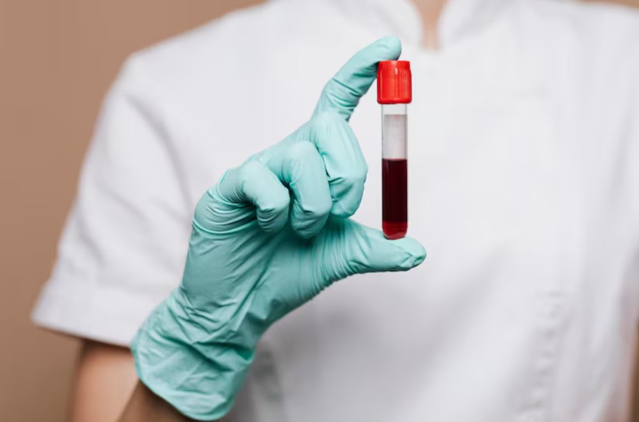 Read more about the article aPTT 검사 수치 상승·저하 의미와 내인성 응고 경로 분석