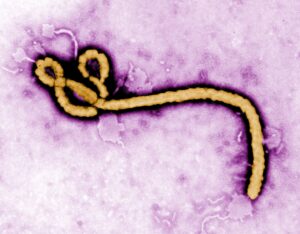 Read more about the article Ebola virus 감염 경로, 치명적 증상, 검사법부터 완치 후 반전까지