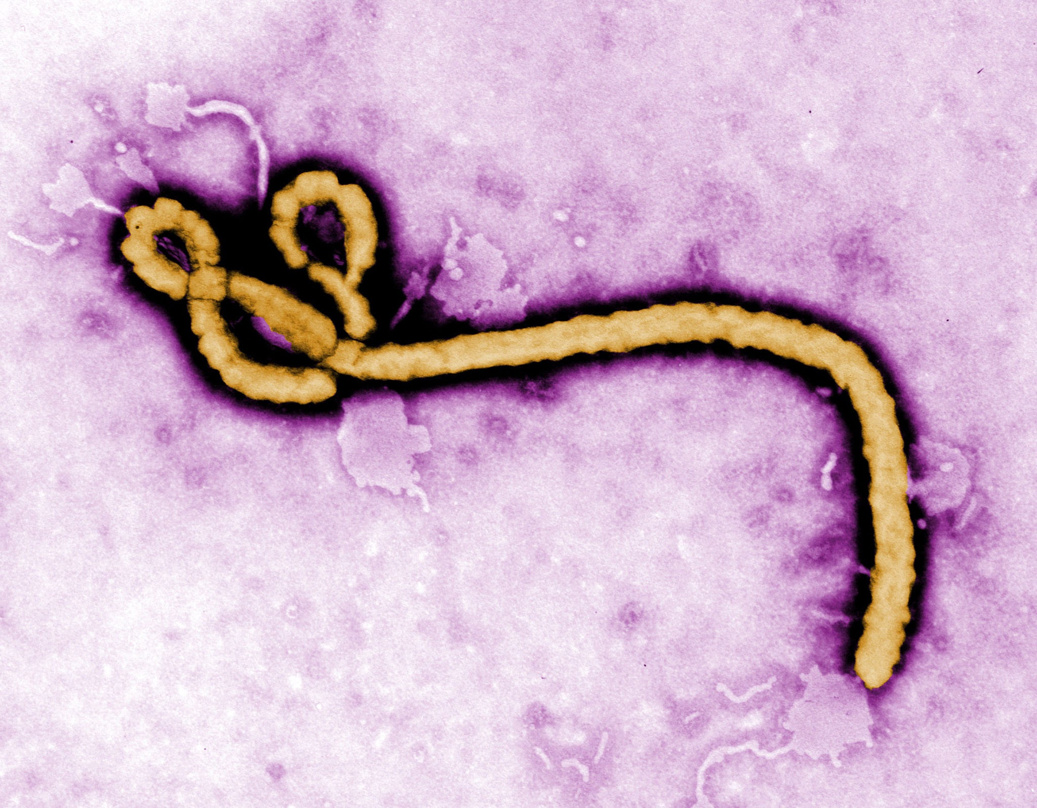 Read more about the article Ebola virus 감염 경로, 치명적 증상, 검사법부터 완치 후 반전까지