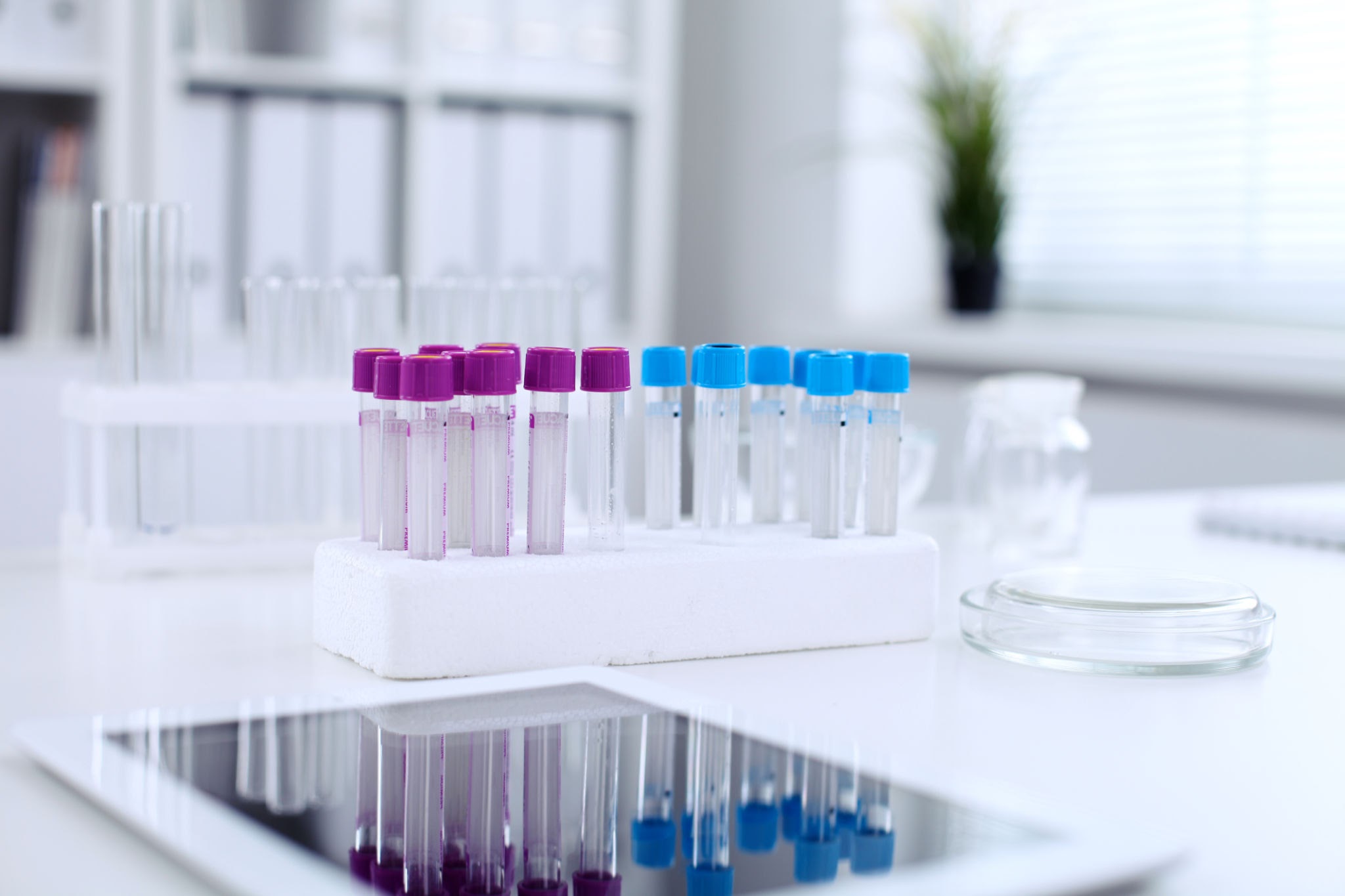 Read more about the article Apolipoprotein A-II 검사 HDL의 안정성과 지질 대사를 조율하는 숨은 열쇠