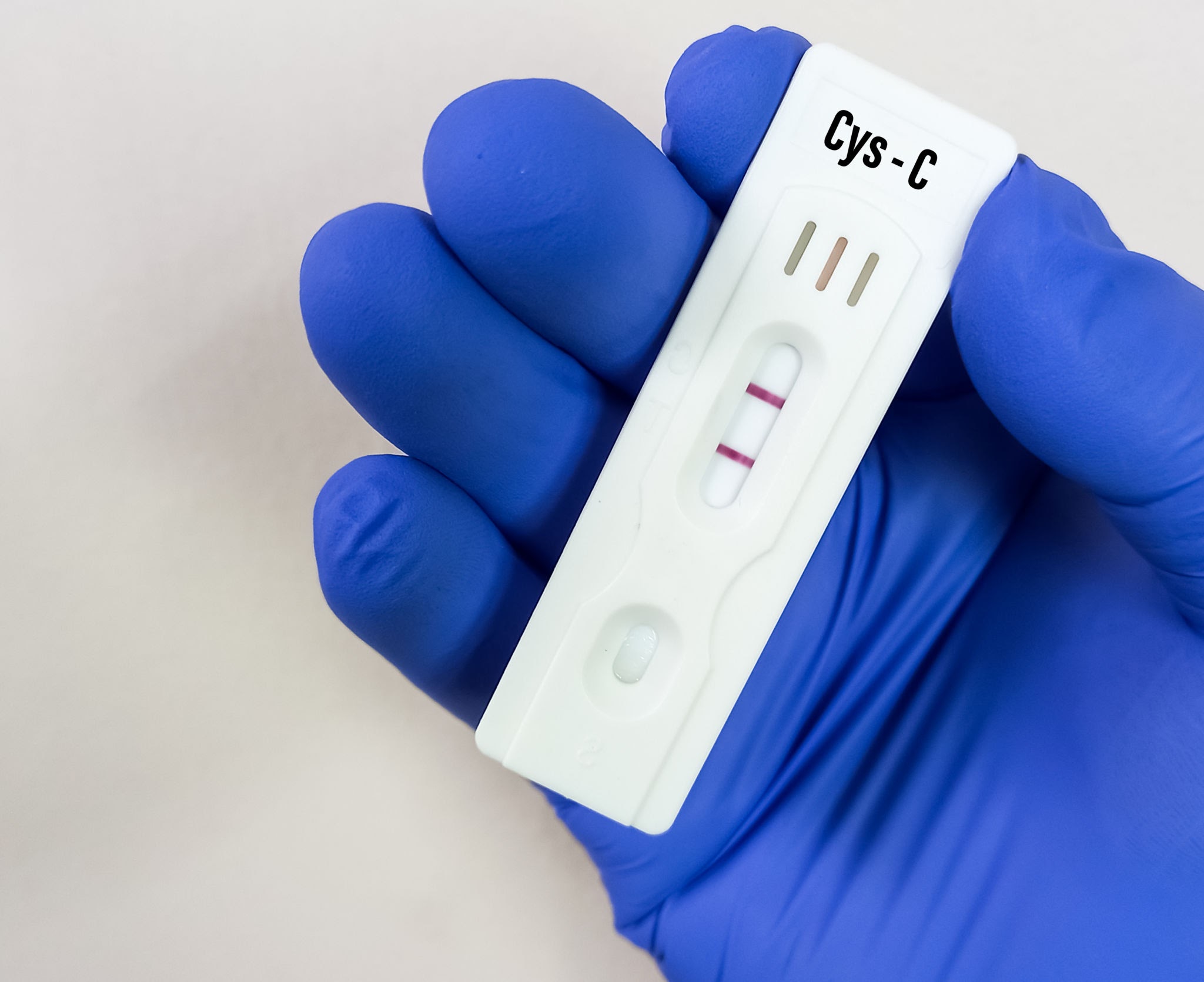 Read more about the article Cystatin C 검사 크레아티닌의 한계를 넘어선 신장 기능의 숨은 지표