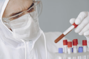 Read more about the article N-Methylformamide (NMF) 검사 DMF 간 독성 노출 지표 및 판독 노하우