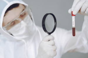 Read more about the article Helicobacter pylori IgG (헬리코박터 항체)’ 검사 피 한 방울로 위암의 주범을 추적한다.
