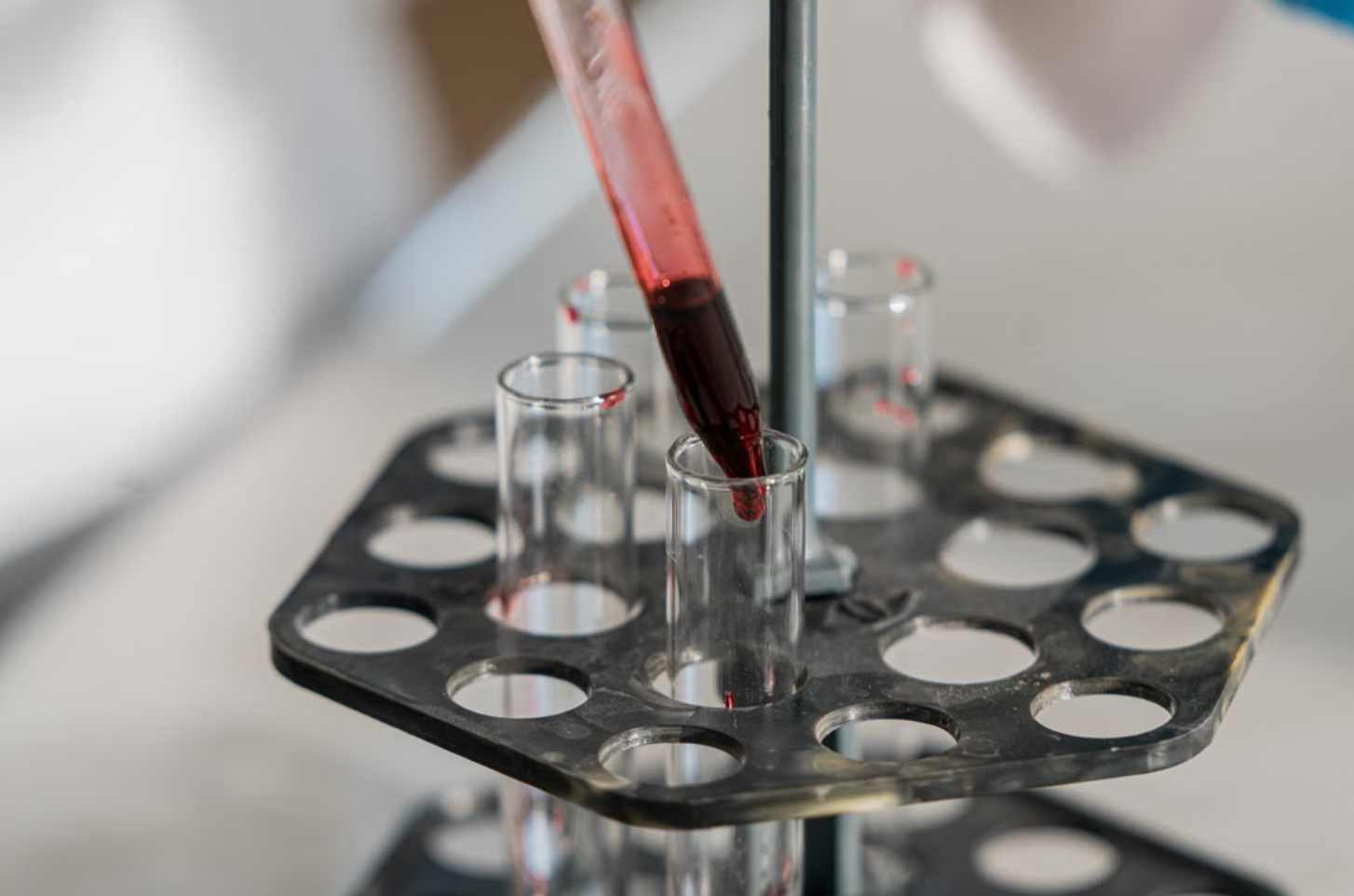 Read more about the article Anti-Jo-1 Ab (항 Jo-1 항체) 검사 자가면역성 다발성 근염 및 간질성 폐질환 정밀 해석
