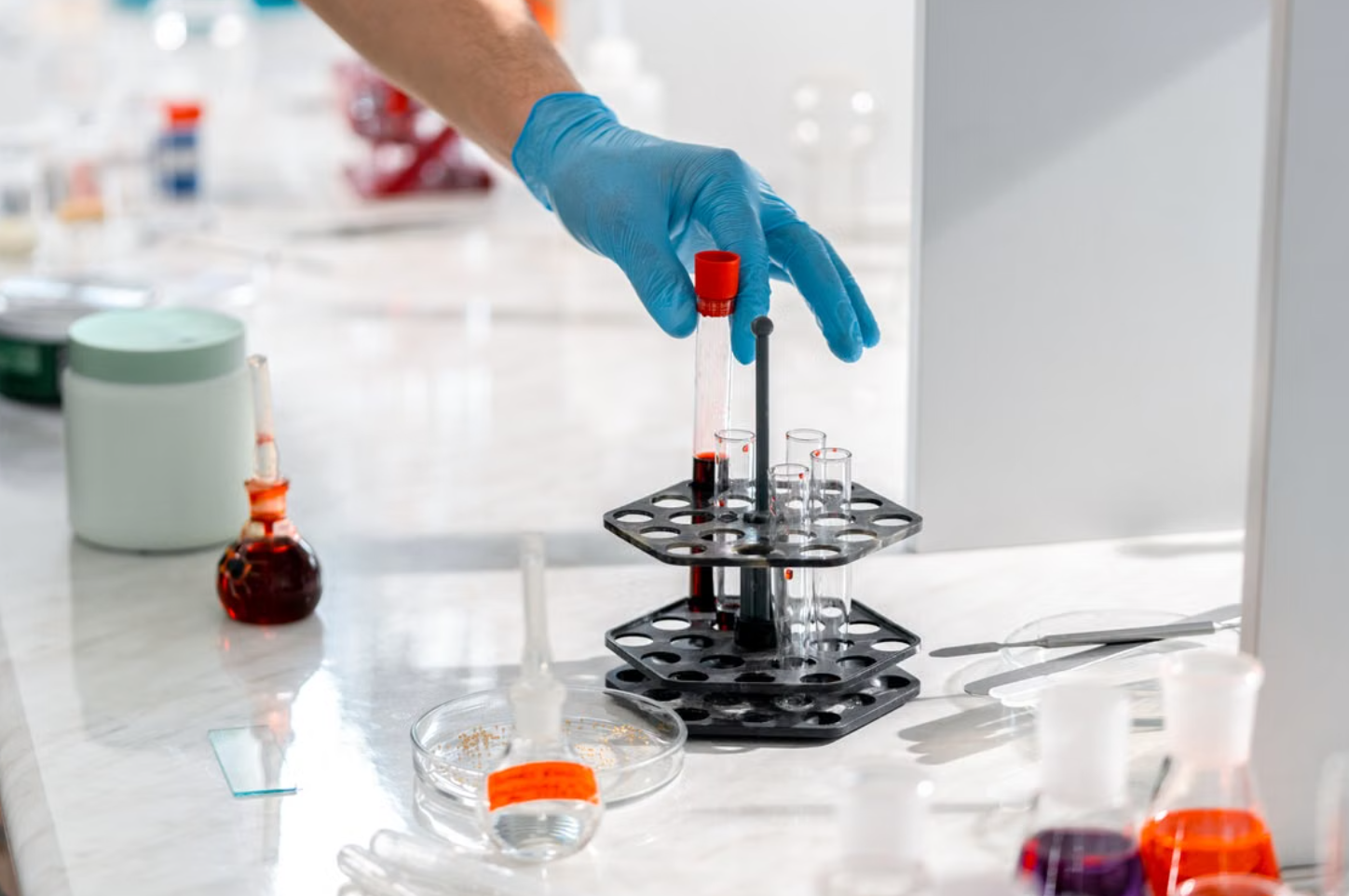 Read more about the article Anti-PR3 (C-ANCA) 검사 육아종성 다발혈관염 진단 및 정밀 해석