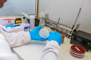Read more about the article KOH preparation (수산화칼륨 현미경 직접) 검사: 진균 감염 정밀 해석