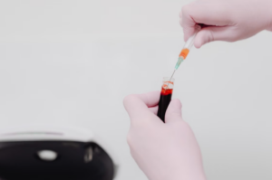 Read more about the article sFlt-1/PlGF ratio (전자간증 위험도) 검사: 임신중독증 조기 예측 및 정밀 해석