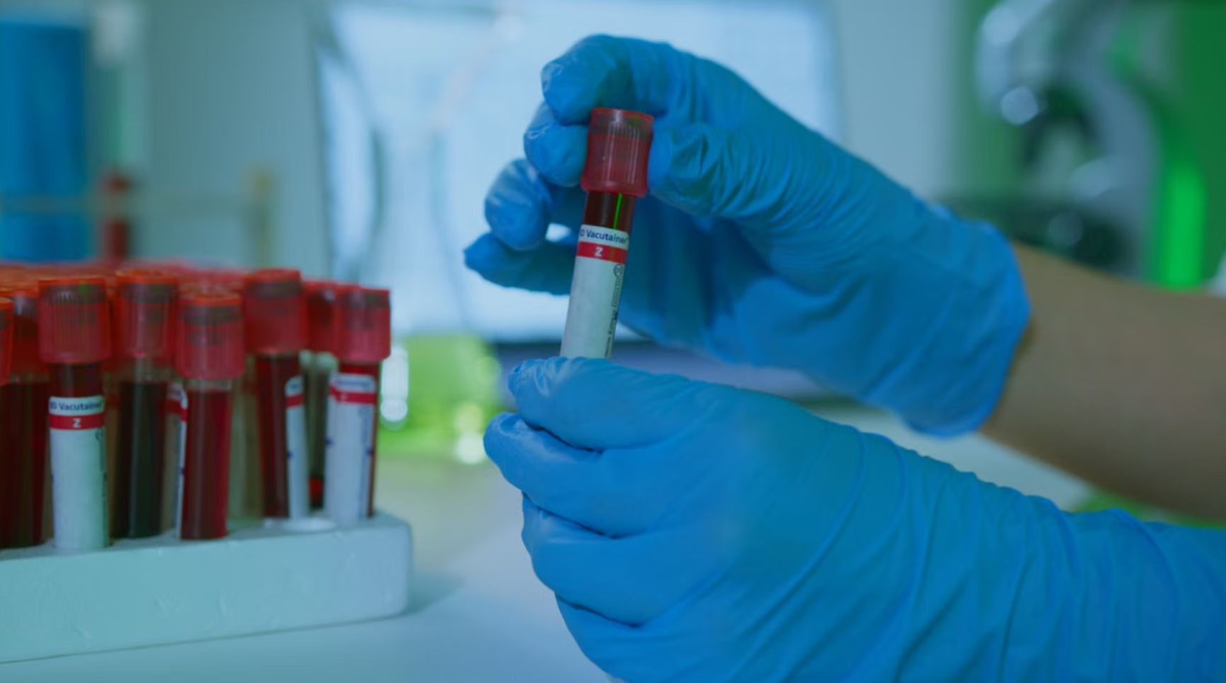 You are currently viewing 혈액점도검사 (Blood Viscosity Test) 심뇌혈관 질환 조기 예측 및 정밀 해석 리포트